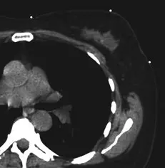 ct_sim_film (1).webp